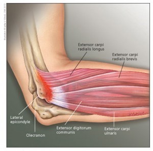 Metastarsophalangeal articulație durere degetul mare în degetului articulația ghecon.ro